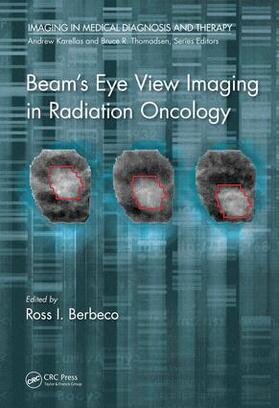 Berbeco / Berbeco, Ph.D. |  Beam's Eye View Imaging in Radiation Oncology | Buch |  Sack Fachmedien