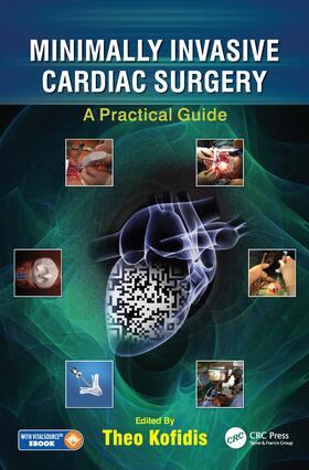 Kofidis |  Minimally Invasive Cardiac Surgery | Buch |  Sack Fachmedien