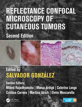 Gonzalez |  Reflectance Confocal Microscopy of Cutaneous Tumors | Buch |  Sack Fachmedien