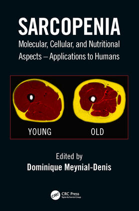 Meynial-Denis |  Sarcopenia | Buch |  Sack Fachmedien