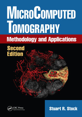 Stock |  MicroComputed Tomography | Buch |  Sack Fachmedien