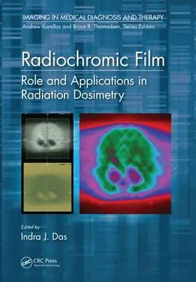 Das |  Radiochromic Film | Buch |  Sack Fachmedien