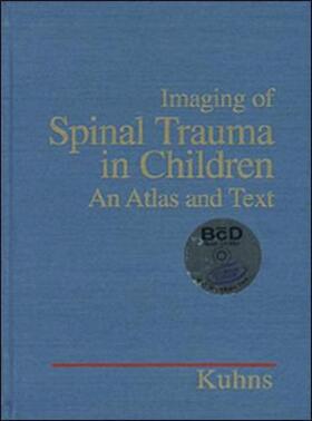 Kuhns |  IMAGING OF SPINAL TRAUMA IN CHILDREN | Medienkombination |  Sack Fachmedien