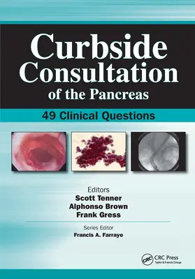 Brown / Tenner / Gress |  Curbside Consultation of the Pancreas | Buch |  Sack Fachmedien