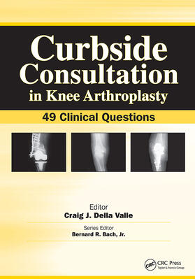 Della Valle |  Curbside Consultation in Knee Arthroplasty | Buch |  Sack Fachmedien