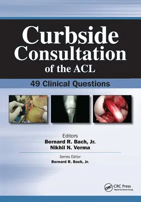 Bach / Verma |  Curbside Consultation of the ACL | Buch |  Sack Fachmedien