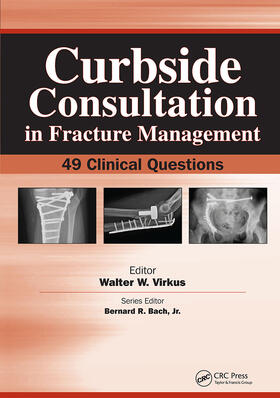 Virkus |  Curbside Consultation in Fracture Management | Buch |  Sack Fachmedien