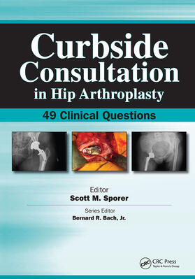 Sporer |  Curbside Consultation in Hip Arthroplasty | Buch |  Sack Fachmedien