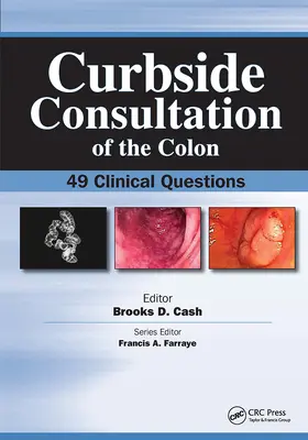 Cash |  Curbside Consultation of the Colon | Buch |  Sack Fachmedien