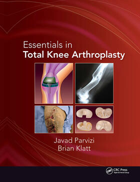 Parvizi / Klatt |  Essentials in Total Knee Arthroplasty | Buch |  Sack Fachmedien