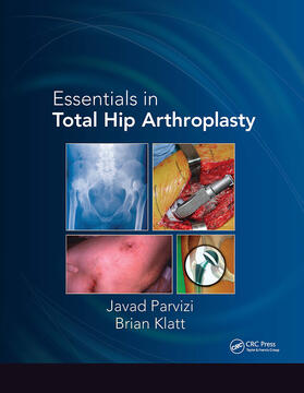 Parvizi / Klatt |  Essentials in Total Hip Arthroplasty | Buch |  Sack Fachmedien