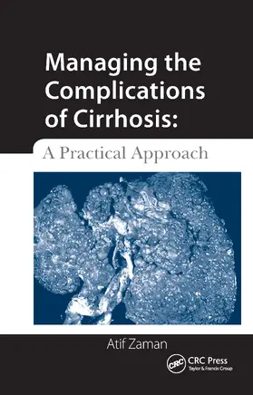 Zaman |  Managing the Complications of Cirrhosis | Buch |  Sack Fachmedien