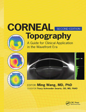Wang |  Corneal Topography | Buch |  Sack Fachmedien