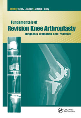 Jacofsky / Hedley |  Fundamentals of Revision Knee Arthroplasty | Buch |  Sack Fachmedien