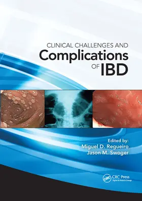 Regueiro / Swoger |  Clinical Challenges and Complications of IBD | Buch |  Sack Fachmedien