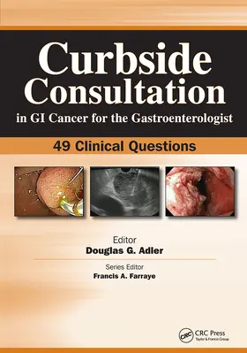 Adler |  Curbside Consultation in GI Cancer for the Gastroenterologist | Buch |  Sack Fachmedien