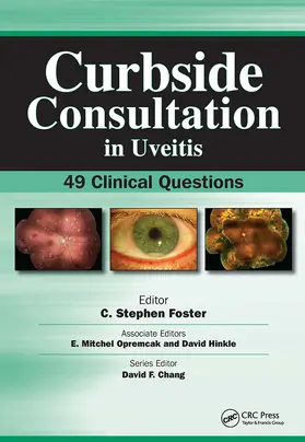 Foster |  Curbside Consultation in Uveitis | Buch |  Sack Fachmedien