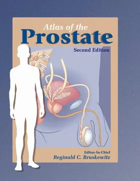 Bruskewitz |  Atlas of the Prostate | Buch |  Sack Fachmedien