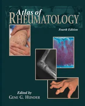 Hunder |  Atlas of Rheumatology | Buch |  Sack Fachmedien