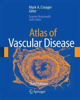 Creager |  Atlas of Vascular Disease | Buch |  Sack Fachmedien