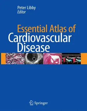 Libby |  Essential Atlas of Cardiovascular Disease | Buch |  Sack Fachmedien