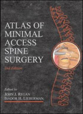Regan / Lieberman |  Atlas of Minimal Access Spine Surgery, Second Edition | Medienkombination |  Sack Fachmedien