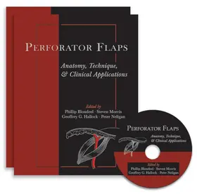 Blondeel / Morris / Hallock |  Perforator Flaps | Buch |  Sack Fachmedien