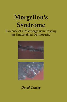 Conroy |  Morgellon's Syndrome | Buch |  Sack Fachmedien