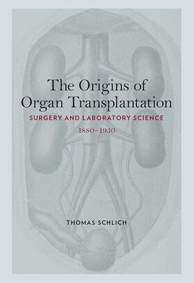 Schlich |  The Origins of Organ Transplantation | eBook | Sack Fachmedien