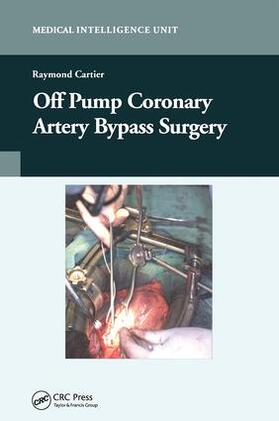 Cartier |  Off-Pump Coronary Artery Bypass Surgery | Buch |  Sack Fachmedien