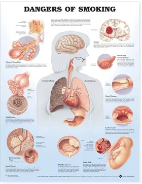  Dangers of Smoking Anatomical Chart | Buch |  Sack Fachmedien