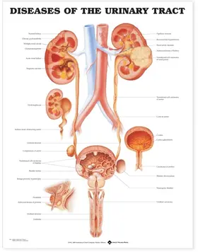  Diseases of the Urinary Tract Anatomical Chart | Sonstiges |  Sack Fachmedien