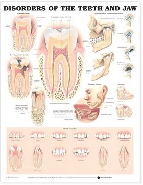  Disorders of the Teeth and Jaw Anatomical Chart | Sonstiges |  Sack Fachmedien