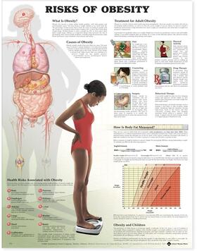  Risks of Obesity Anatomical Chart | Sonstiges |  Sack Fachmedien