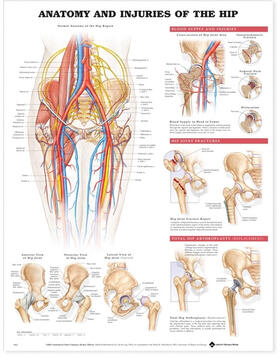  Anatomy and Injuries of the Hip Anatomical Chart | Sonstiges |  Sack Fachmedien
