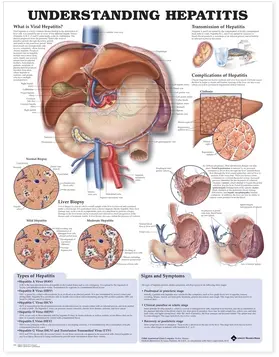  Understanding Hepatitis Anatomical Chart | Sonstiges |  Sack Fachmedien