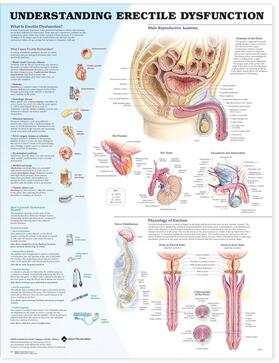  Understanding Erectile Dysfunction Anatomical Chart | Sonstiges |  Sack Fachmedien