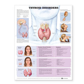  Thyroid Disorders Anatomical Chart | Sonstiges |  Sack Fachmedien