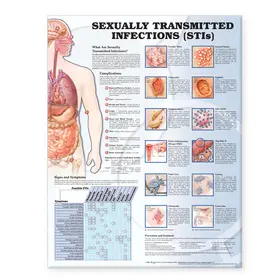  Sexually Transmitted Infections Anatomical Chart | Sonstiges |  Sack Fachmedien