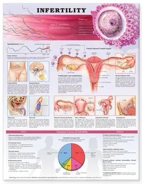  Infertility Anatomical Chart | Sonstiges |  Sack Fachmedien