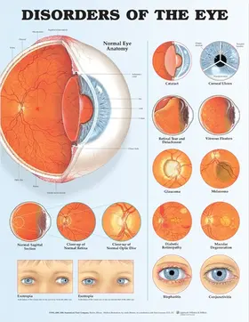  Disorders of the Eye Anatomical Chart | Sonstiges |  Sack Fachmedien