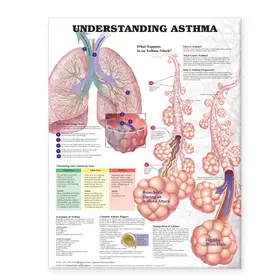  Understanding Asthma Anatomical Chart | Sonstiges |  Sack Fachmedien