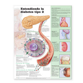 Understanding Type 2 Diabetes Anatomical Chart in Spanish (Comprendiendo la diabetes tipo 2) | Sonstiges | 978-1-58779-958-7 | sack.de