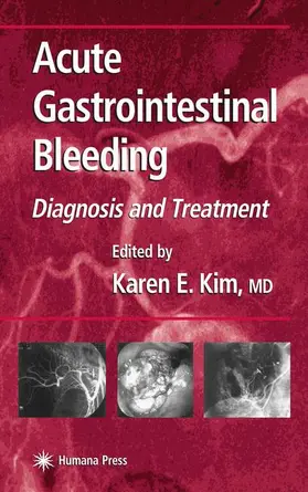 Kim |  Acute Gastrointestinal Bleeding | Buch |  Sack Fachmedien