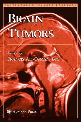 Ali-Osman |  Brain Tumors | Buch |  Sack Fachmedien