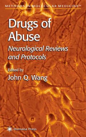 Wang |  Drugs of Abuse | Buch |  Sack Fachmedien