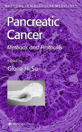 Su |  Pancreatic Cancer | Buch |  Sack Fachmedien