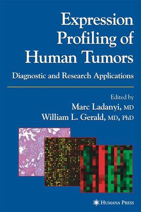 Gerald / Ladanyi |  Expression Profiling of Human Tumors | Buch |  Sack Fachmedien
