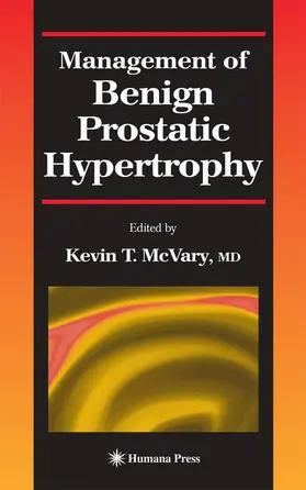 McVary |  Management of Benign Prostatic Hypertrophy | Buch |  Sack Fachmedien