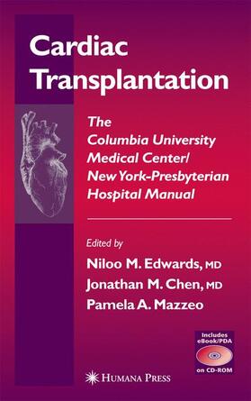 Edwards / Chen / Mazzeo | Cardiac Transplantation | Buch | 978-1-58829-181-3 | sack.de